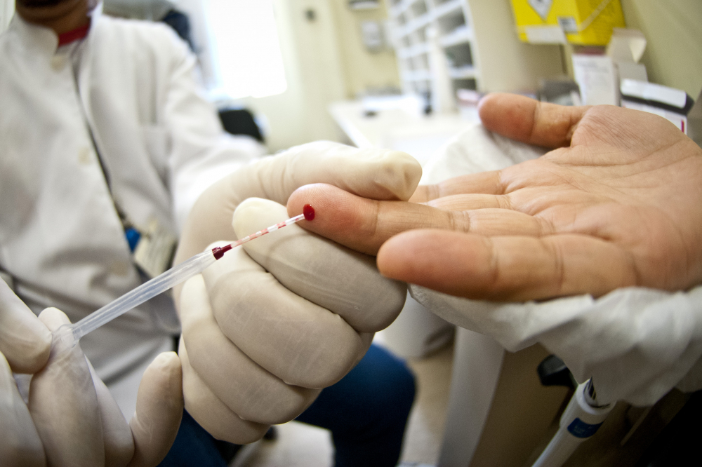 Taxa de detecção de AIDS e HIV cresce no Brasil