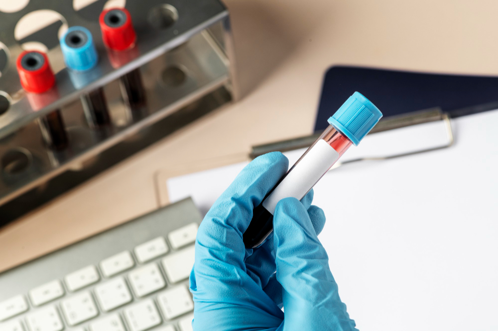 Estados Unidos identificam primeiro caso de nova cepa de Mpox em viajante