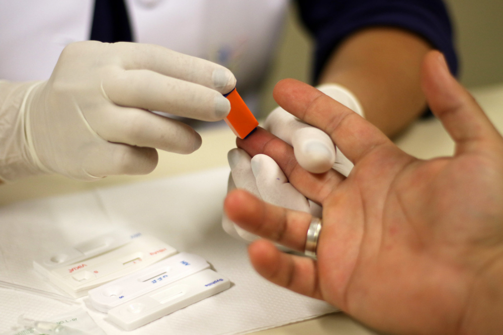 Brasil atinge 1 milhão de pacientes com HIV em tratamento médico