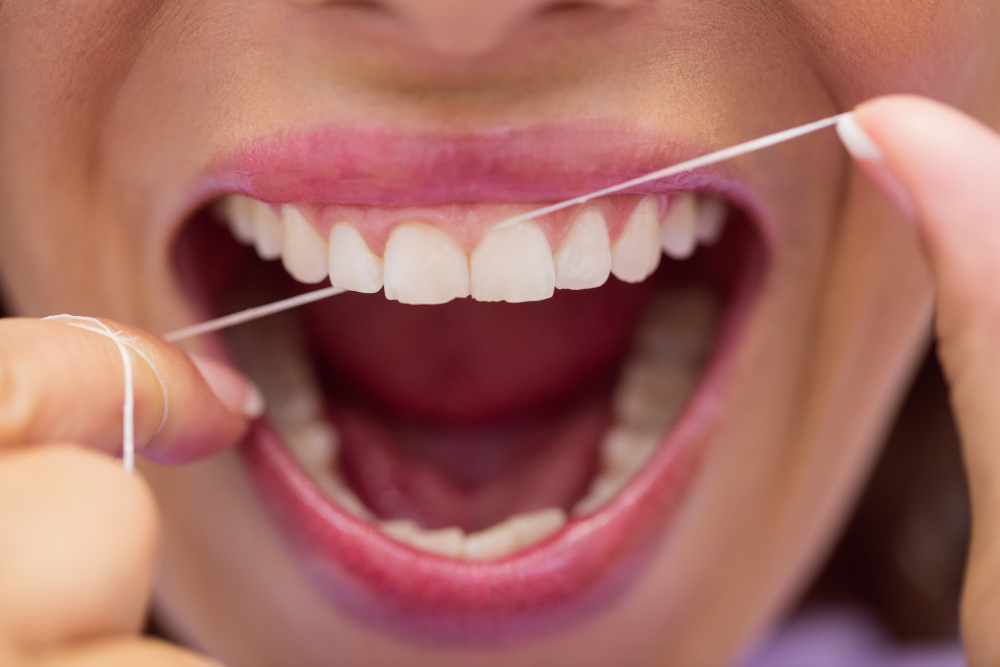 Uso de fio dental pode reduzir risco de derrames, aponta pesquisa