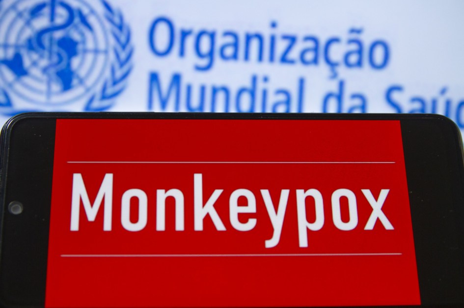 OMS Varíola dos macacos