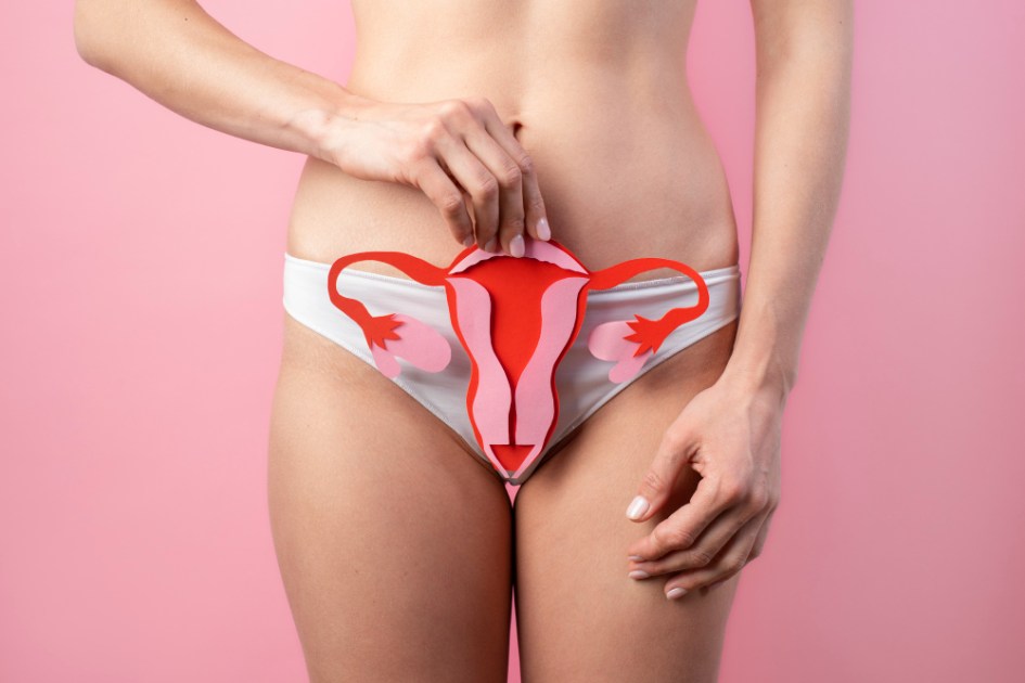 endometriose