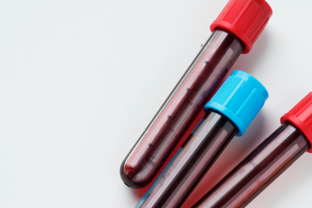 Policitemia Vera: novas perspectivas no tratamento da doença rara do sangue