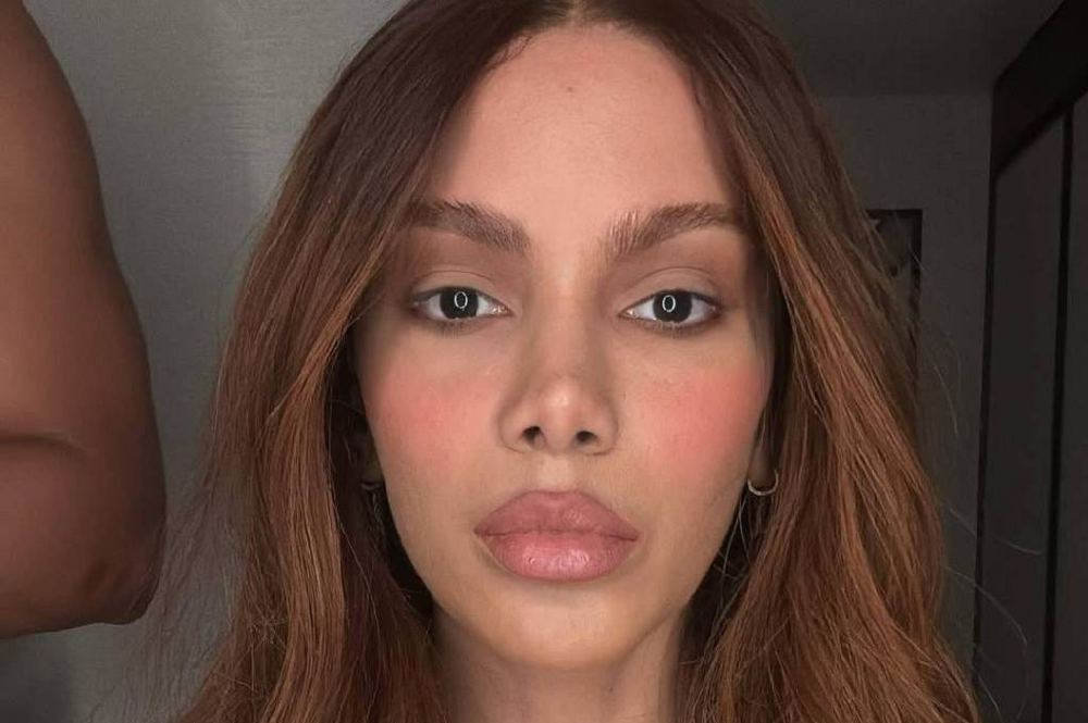Anitta fala pela primeira vez sobre novos procedimentos estéticos: 'O corpo é meu'
