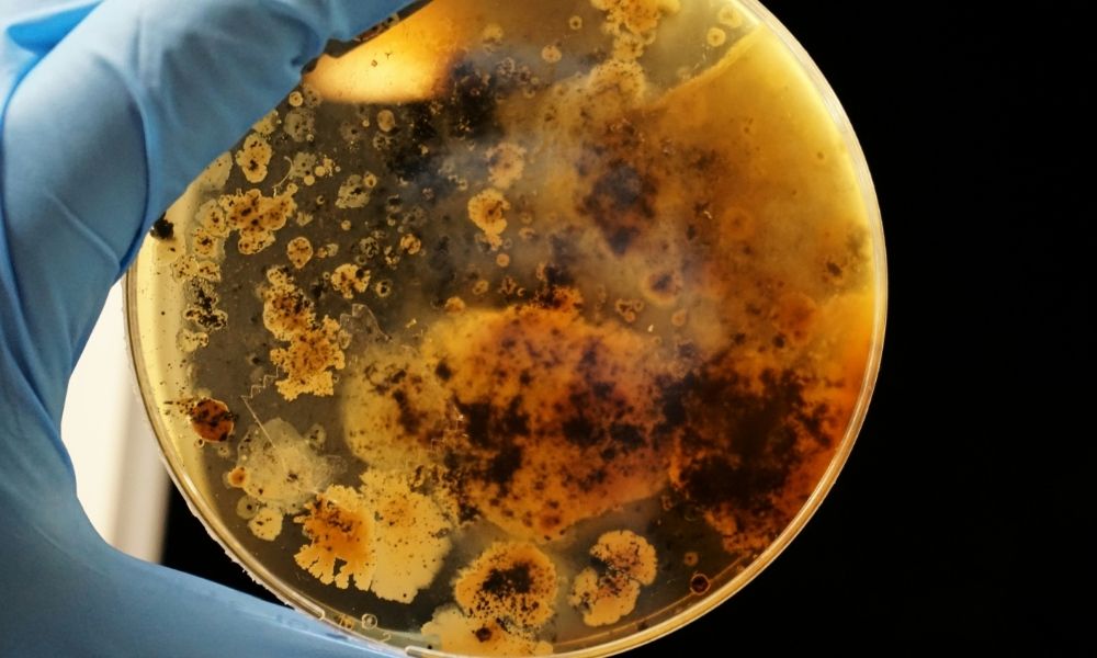Uma em cada seis infecções bacterianas no mundo é resistente a antibióticos, alerta OMS