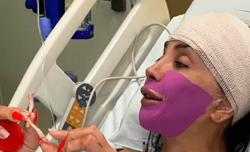 Maya Massafera retira ossos do maxilar em nova cirurgia