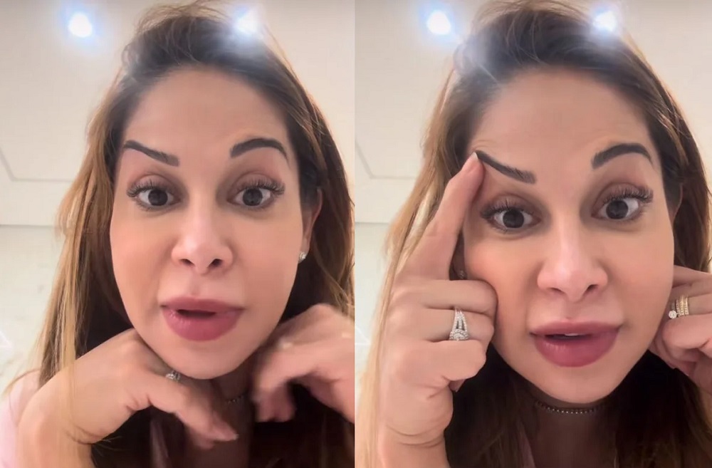 Maíra Cardi exibe rosto deformado após botox dar errado: 'Olha que palhaçada'