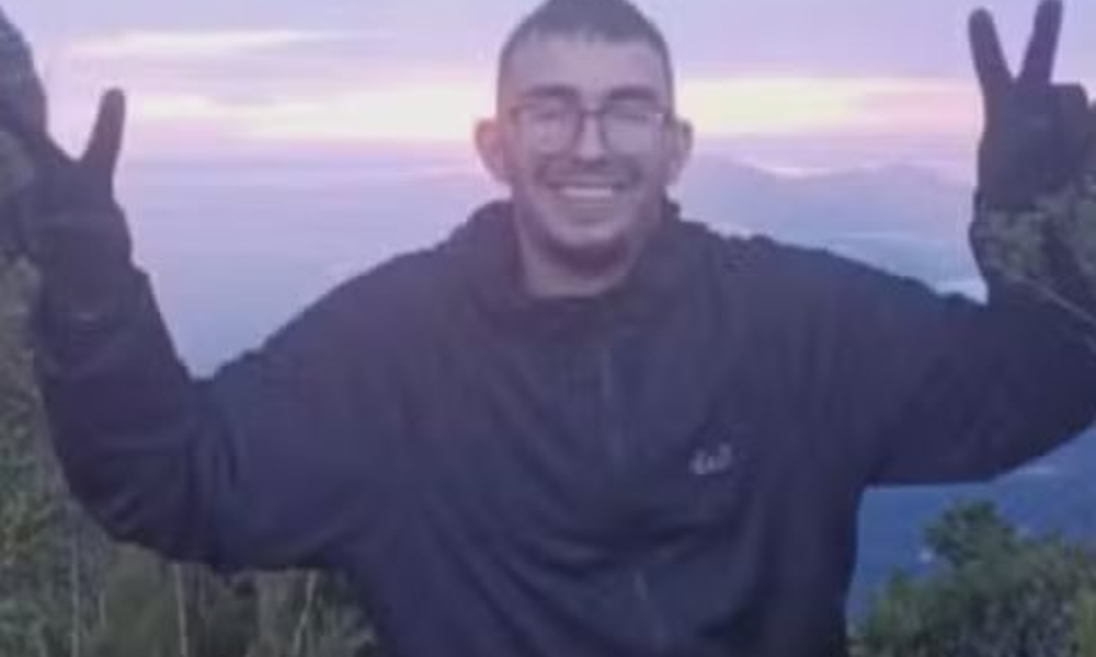 Irmã mostra lesões do jovem que ficou desaparecido por 4 dias em trilha no Paraná