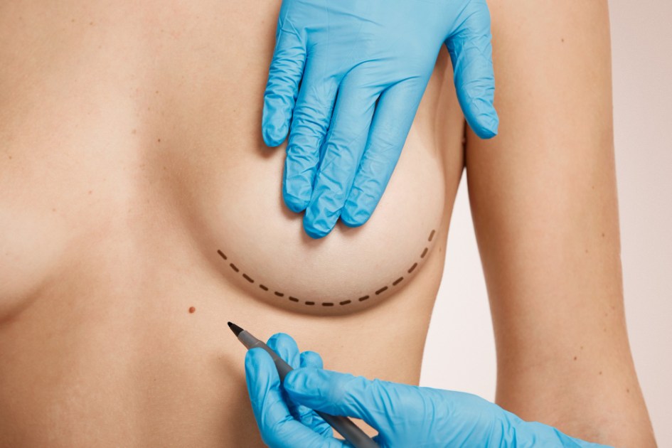 Cirurgia plástica