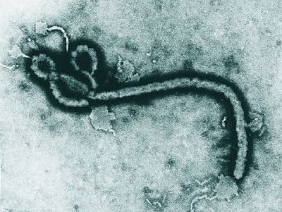 São Paulo investiga caso suspeito de Ebola em homem de 37 anos
