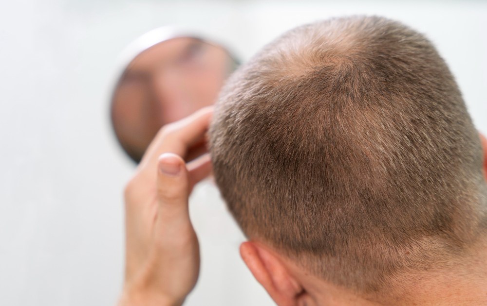 Cabelo, identidade e autoestima – a dimensão emocional da sa