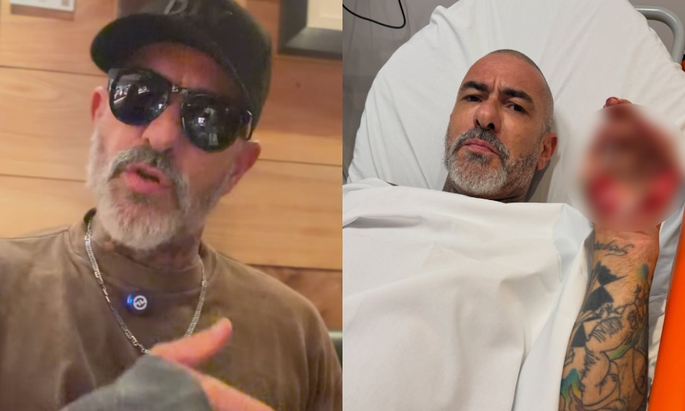 Chef Henrique Fogaça sofreu acidente de moto em maio e se ausentou de episódios do MasterChef Brasil