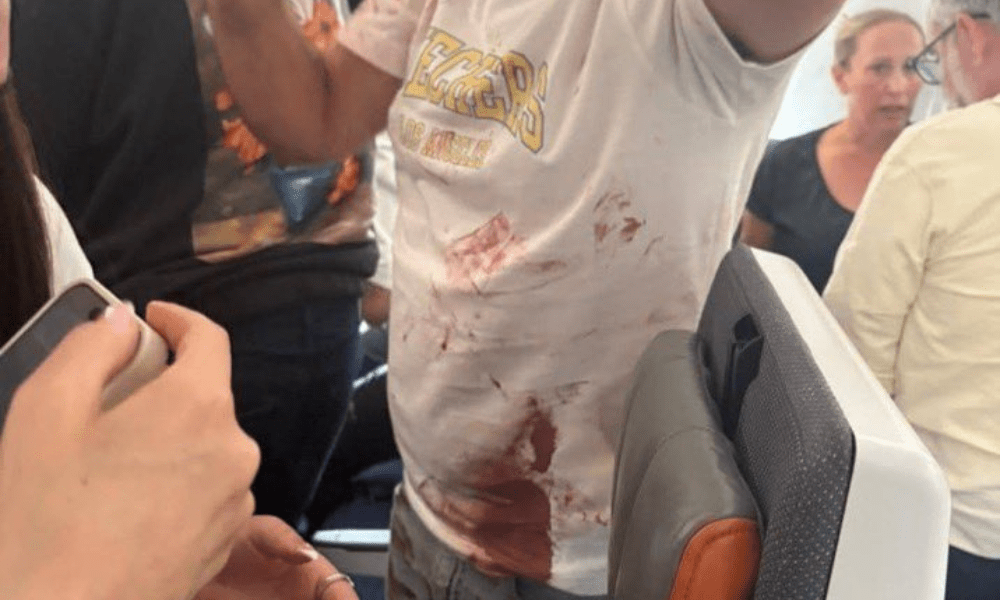 Passageiros aparecem ensanguentados após briga entre pilotos durante voo da Flydubai com destino a Israel