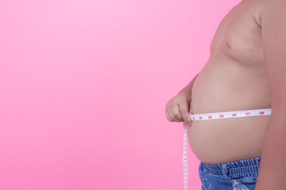 Obesidade infantil